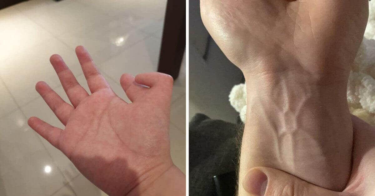 19 persone che hanno tratti fisici che le rendono uniche