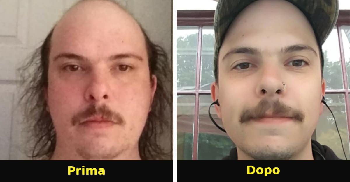 La scelta della vita! 15 foto del prima e dopo di ex alcolisti