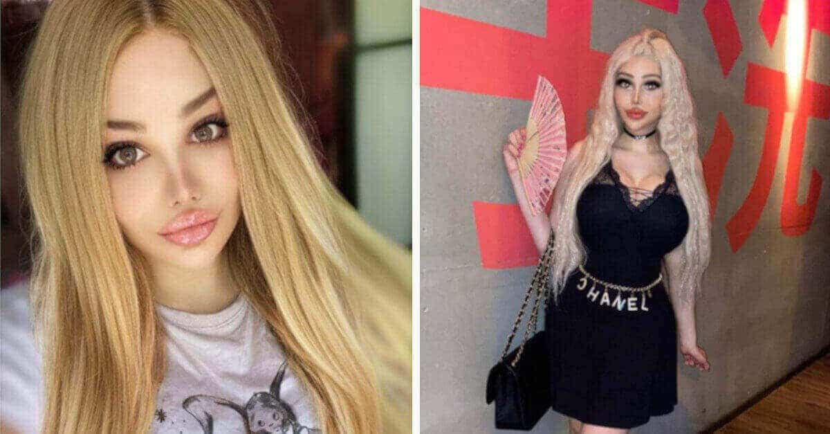 22enne spende più di 82.000€ in interventi di chirurgia e dice di essere “troppo bella per lavorare”