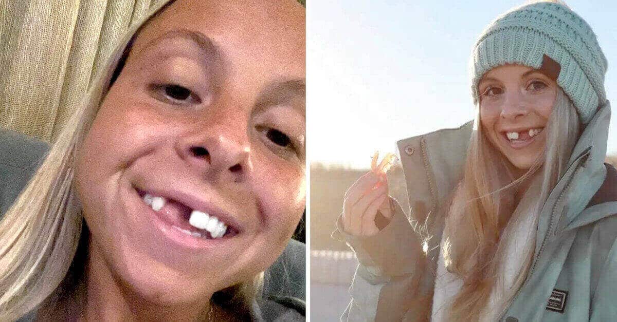 L’influencer sdentata ha superato la frustrazione di essere giudicata: “Ora non mi interessa”