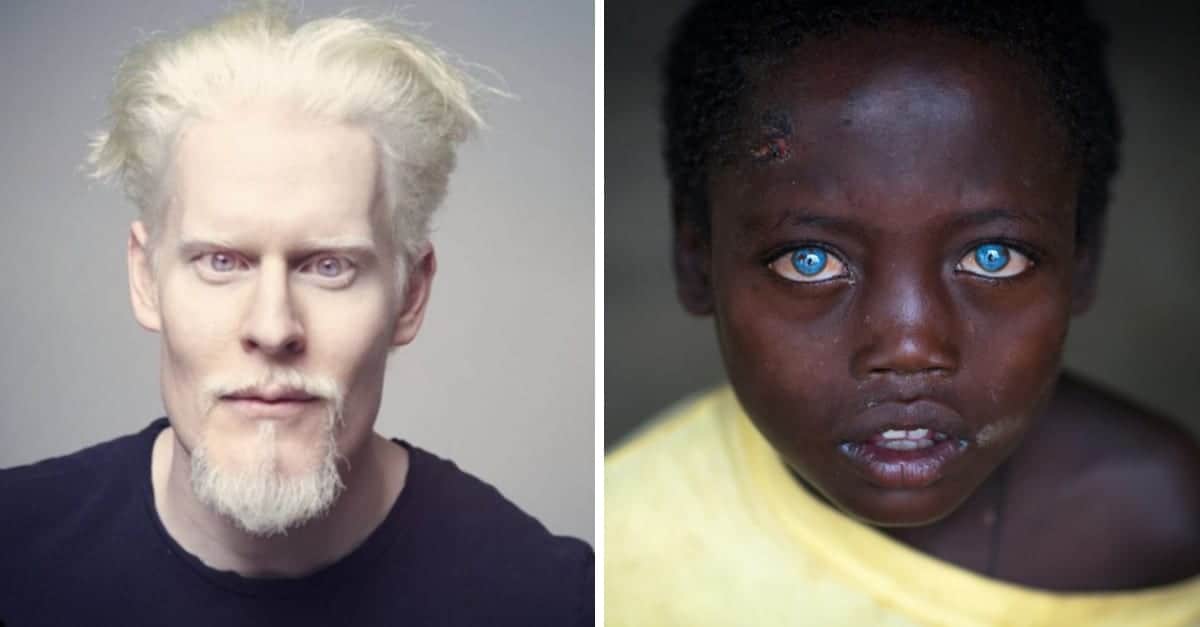 12 foto di persone con una bellezza unica e rara