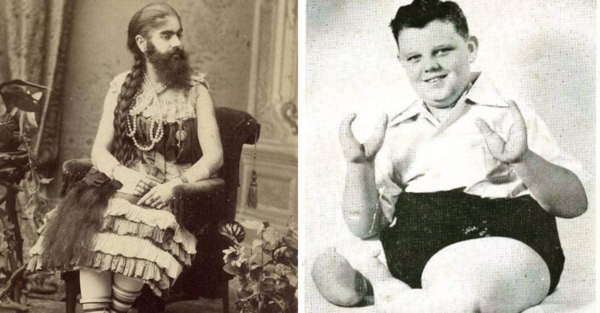 10 Foto di persone che si esibivano in spettacoli come ” fenomeni da baraccone”