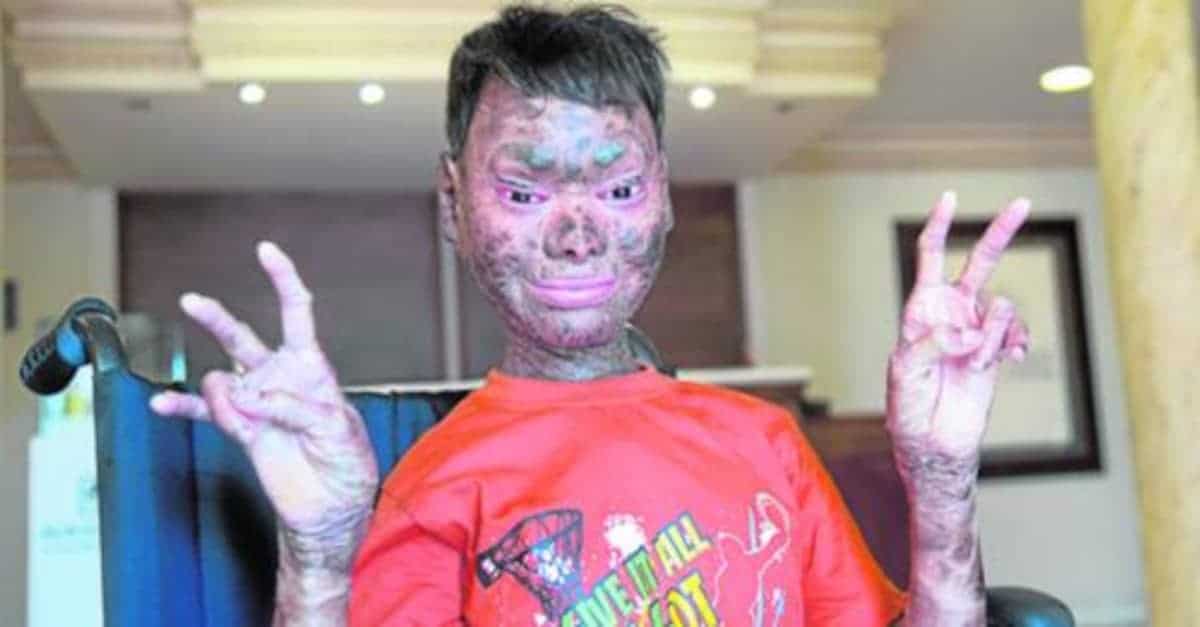 La “ragazza serpente” sorprende con il suo nuovo aspetto dopo l’operazione