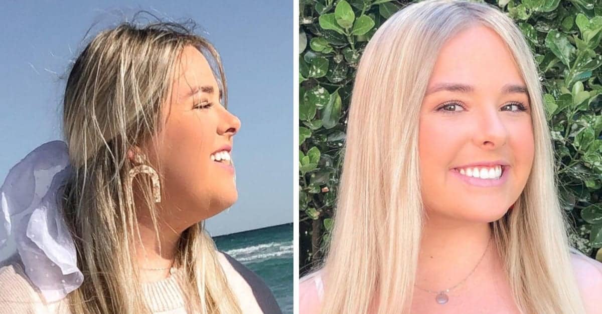 16 Persone che hanno deciso di sottoporsi a chirurgia plastica e non si sono mai pentite