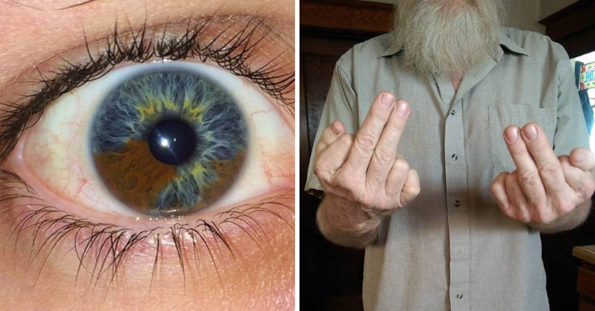 13 caratteristiche genetiche uniche e rare