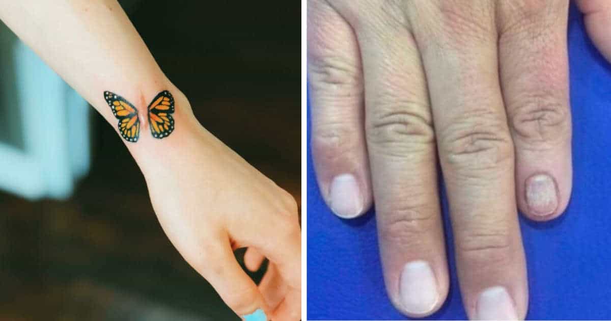 32 persone che hanno chiesto ai tatuatori di coprire le proprie cicatrici e voglie e non potrebbero essere più felici del risultato