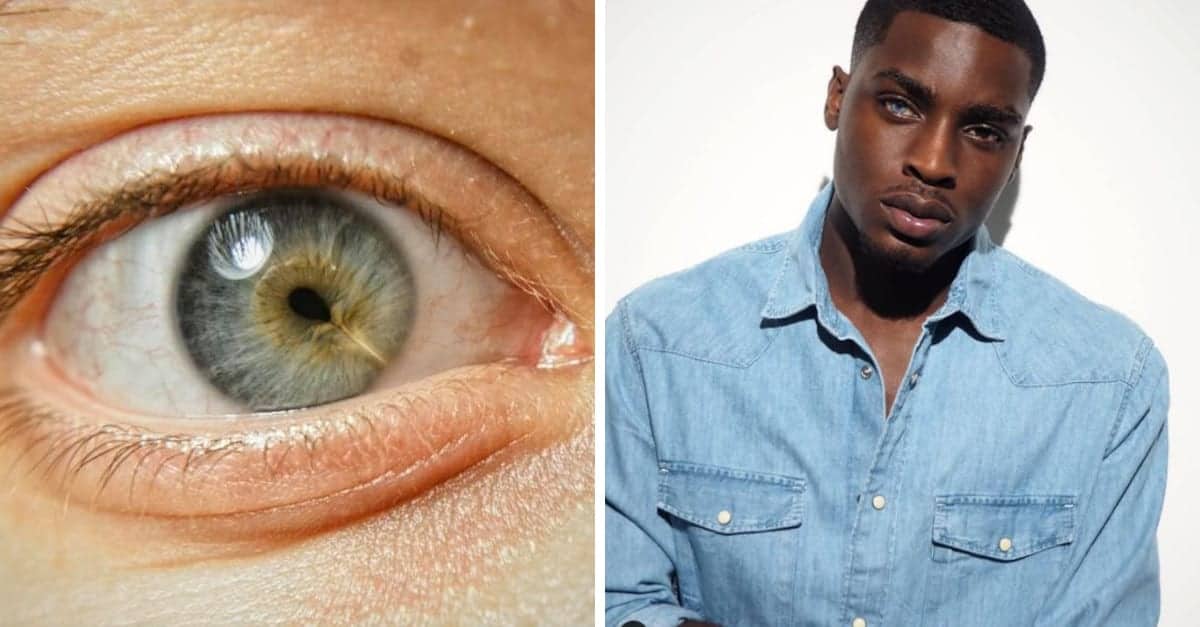 15 persone con caratteristiche genetiche uniche e rare