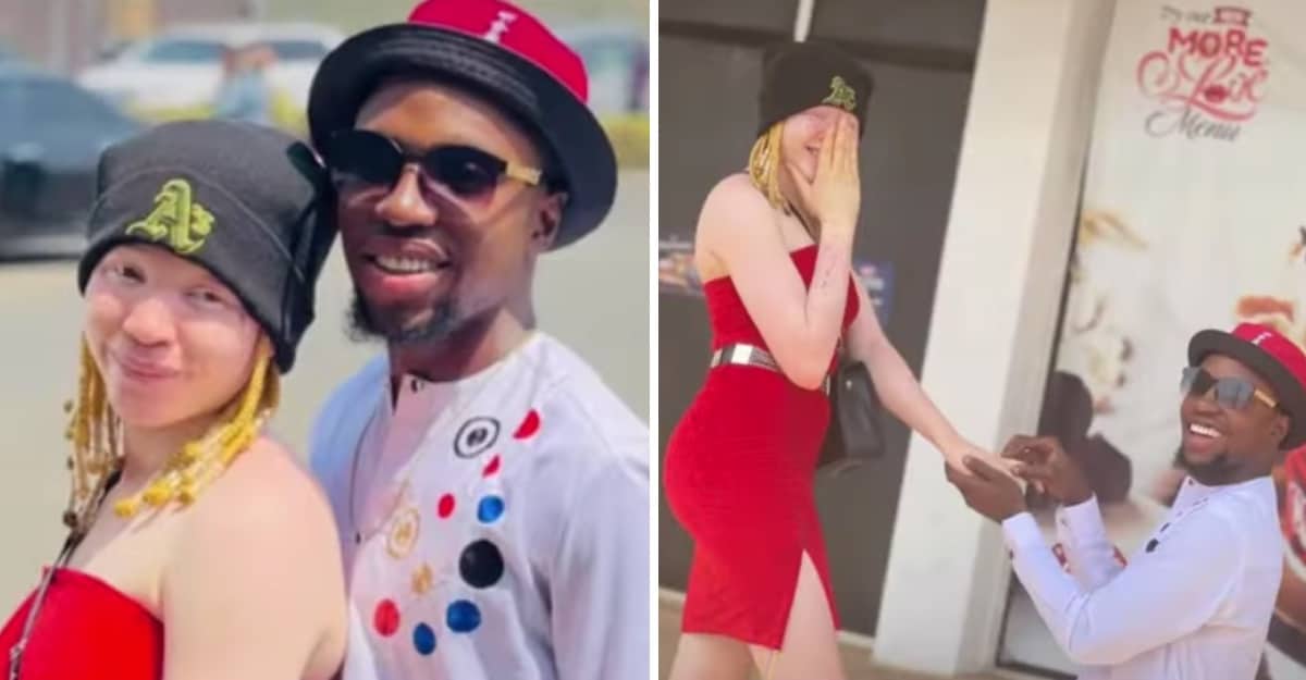 “Sono dipendente da lei”: il giovane fa la proposta di matrimonio alla giovane donna albina rifiutata dalla famiglia