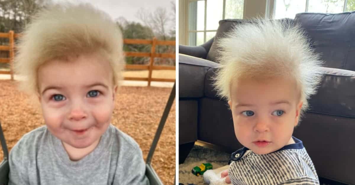Il bambino perde i capelli scuri e cresce una “peluria” color pesca per una rara condizione