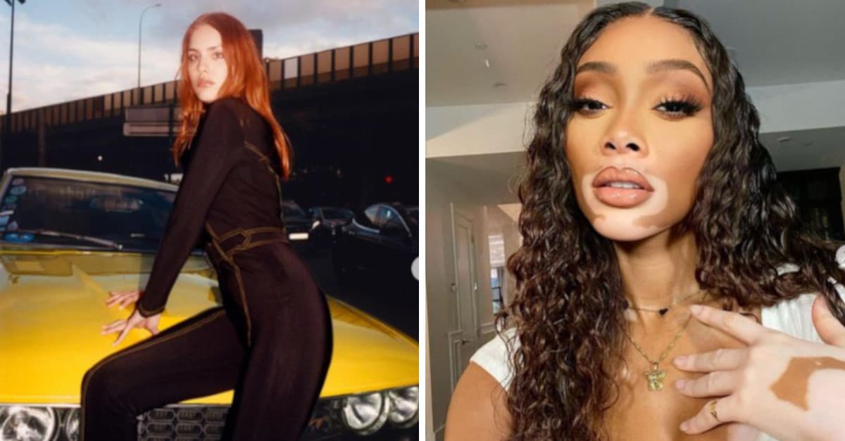 8 modelle che stanno ridefinendo i canoni dell’industria della moda