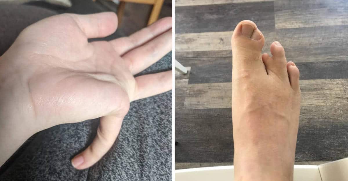 15 Foto di persone nate con caratteristiche che le rendono uniche