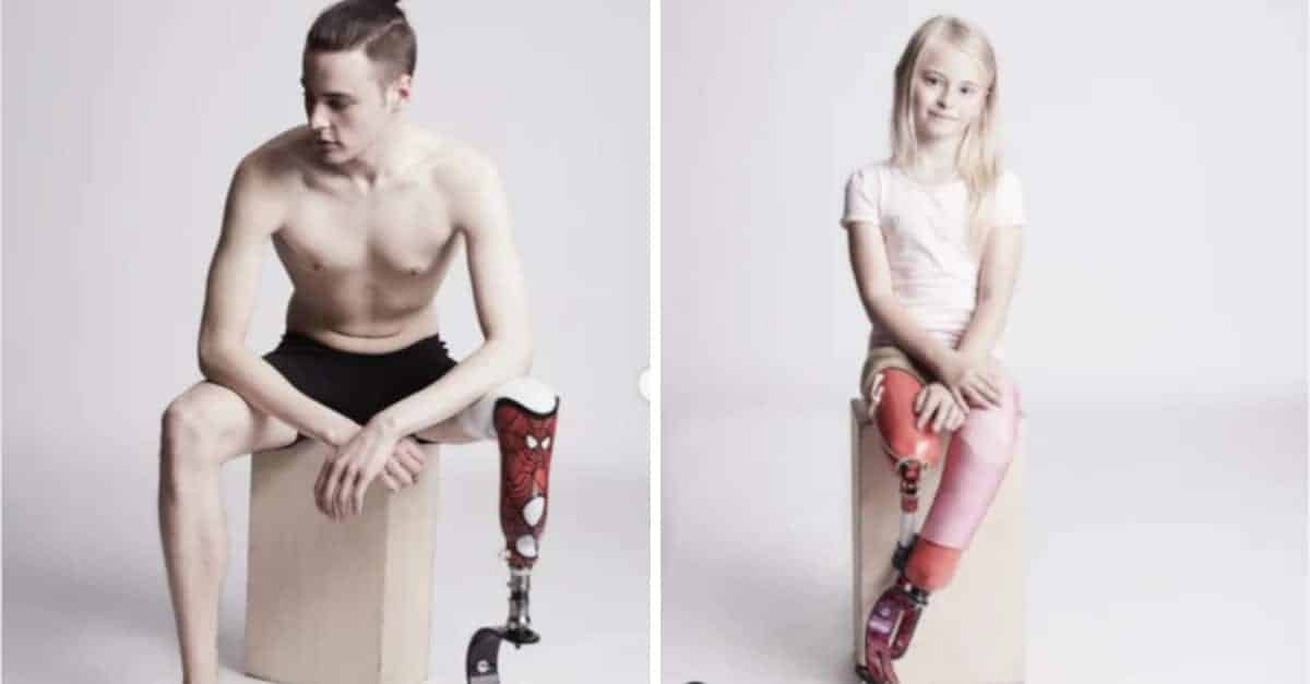13 persone con disabilità sfoggiano con orgoglio il proprio corpo