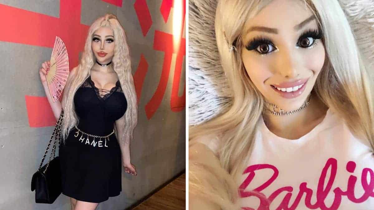 La donna dice che è “troppo carina per lavorare” e spende oltre 82.000 sterline in interventi chirurgici