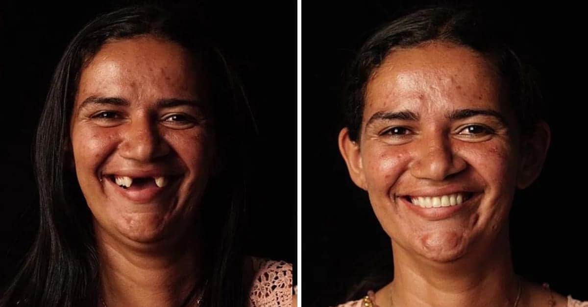 Il dentista trasforma i denti in tutto il mondo e le foto prima e dopo sono fantastiche: 10 esempi