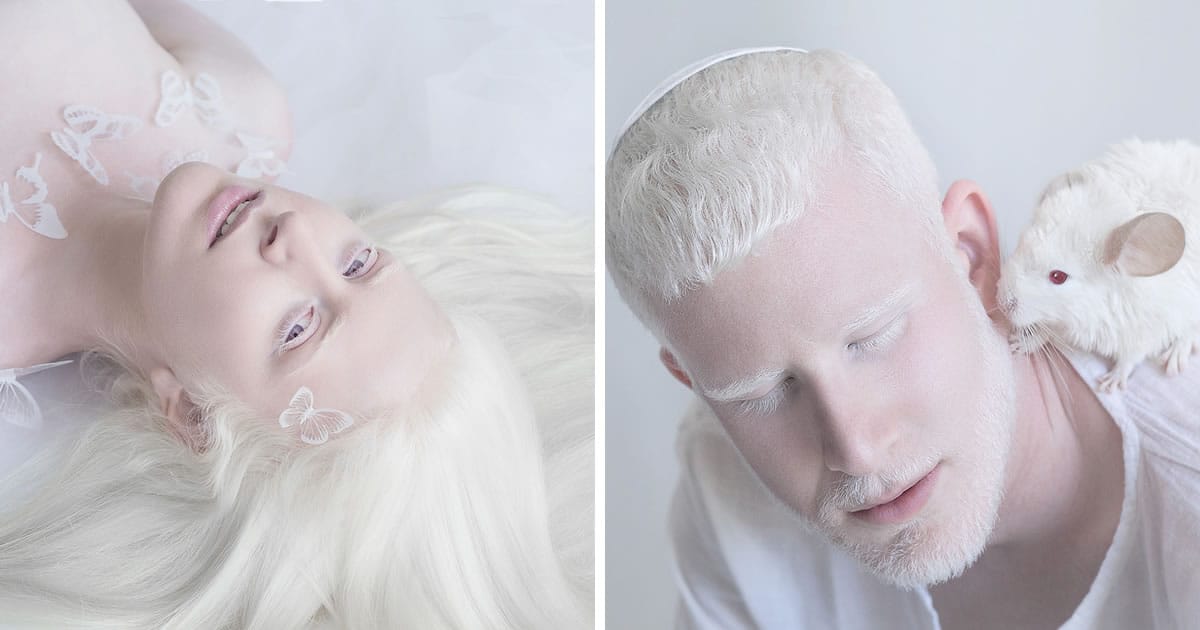 La fotografa Yulia Taits ha catturato la bellezza delle persone con albinismo: 15 Foto
