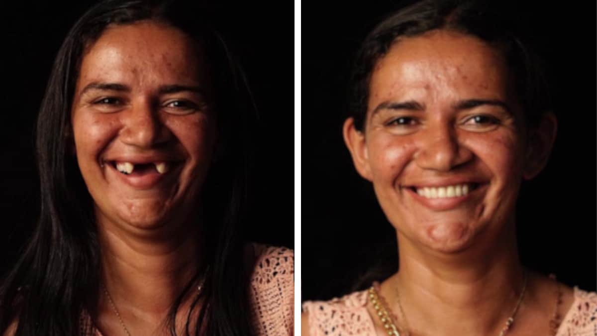 16 Foto di persone prima e dopo i loro “denti nuovi”