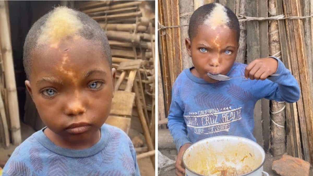 Bimbo africano viene adulato per i suoi occhi azzurri e il suo marchio a forma di fulmine: “Che bello essere di luce”