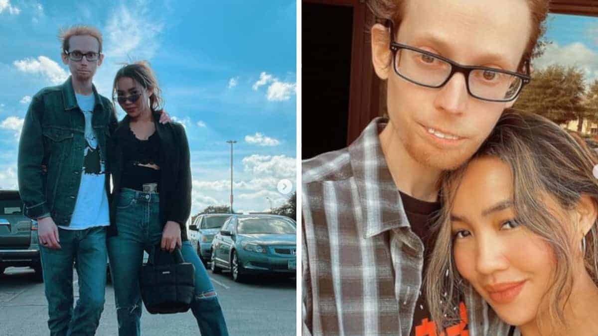 “Troppo brutto per te”: il marito viene preso in giro per il suo aspetto diverso dalla moglie
