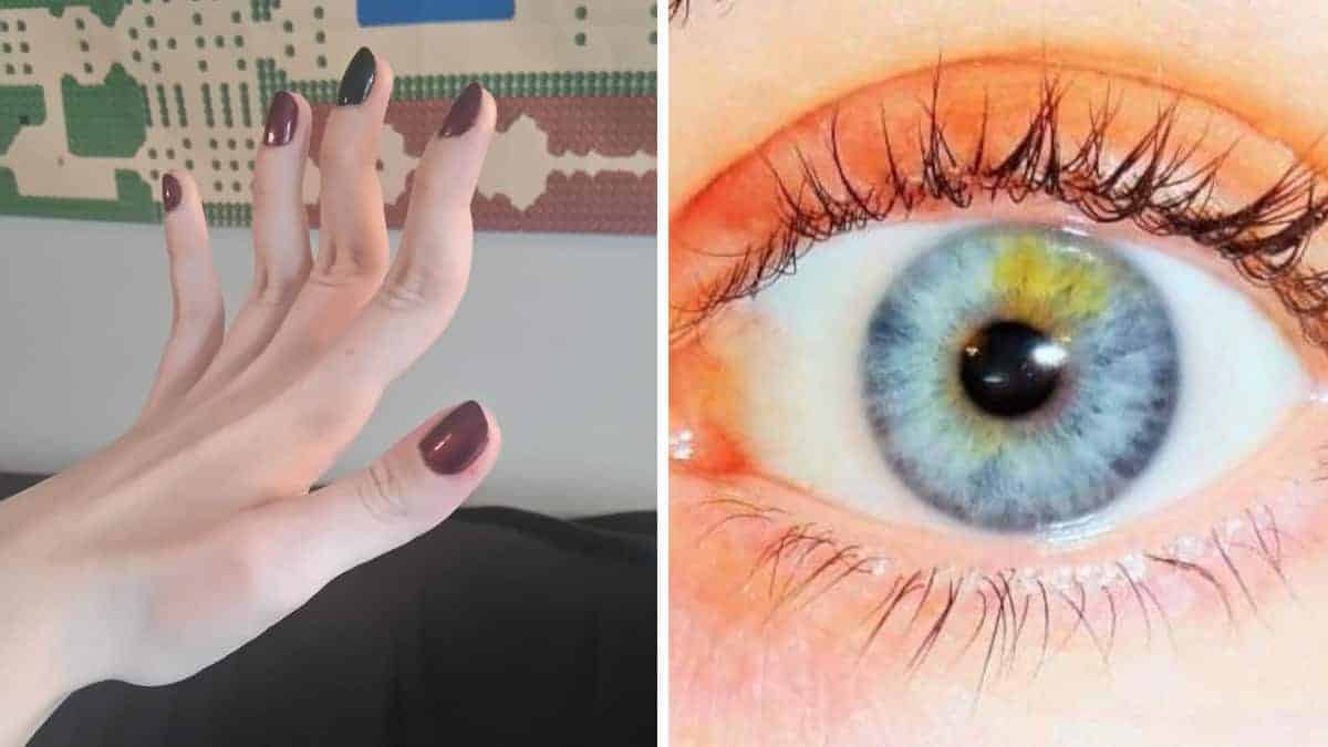 13 persone che hanno tratti fisici unici