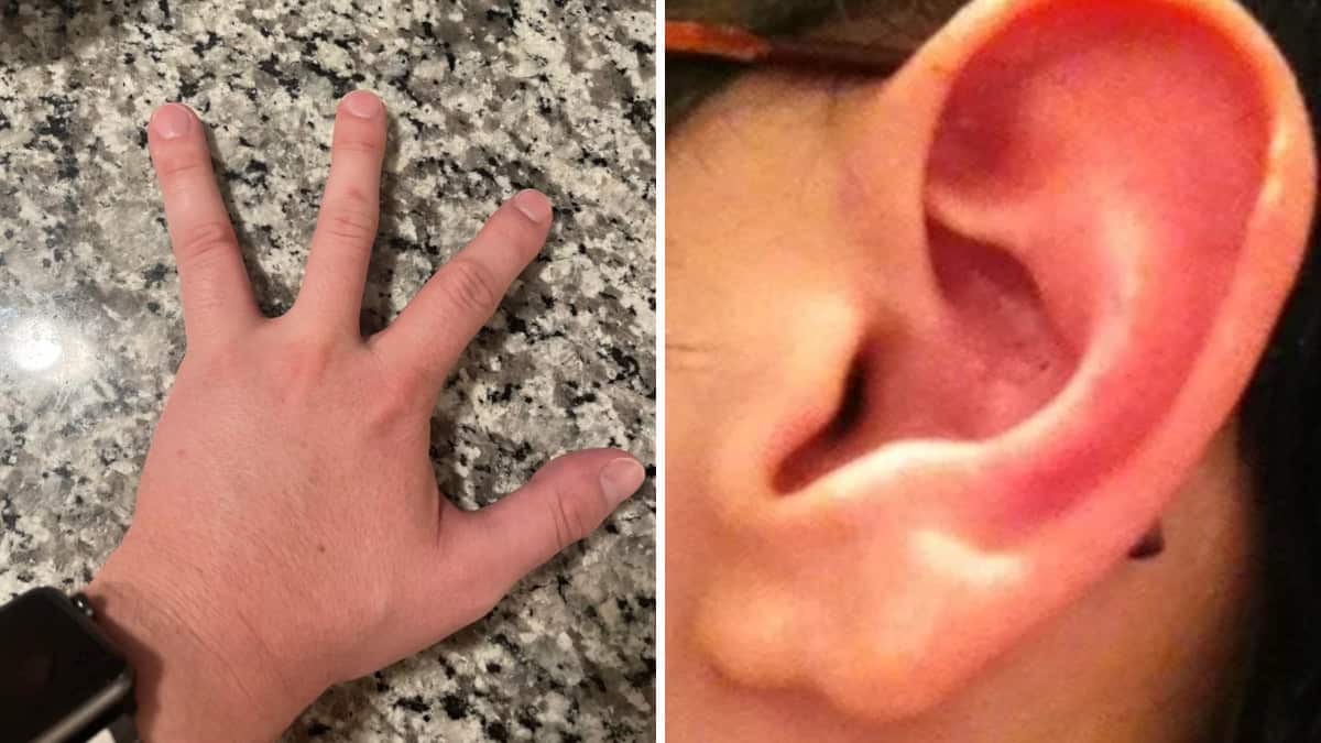 18 persone con caratteristiche fisiche assolutamente uniche