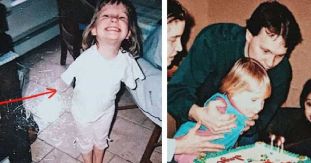 Bimba senza mani viene adottata a 2 anni. Ecco com’è oggi Inga a 21 anni
