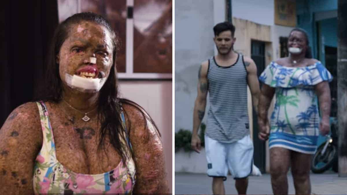 Uomo sostiene e ama incondizionatamente una donna giudicata “mostruosa” dalla società, accogliendo i suoi figli come propri