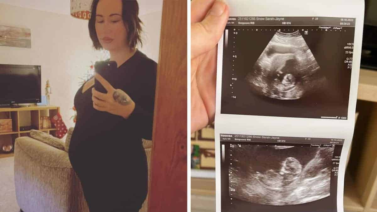 Donna incinta di un uomo sconosciuto cerca assistenza sui social media per trovarlo