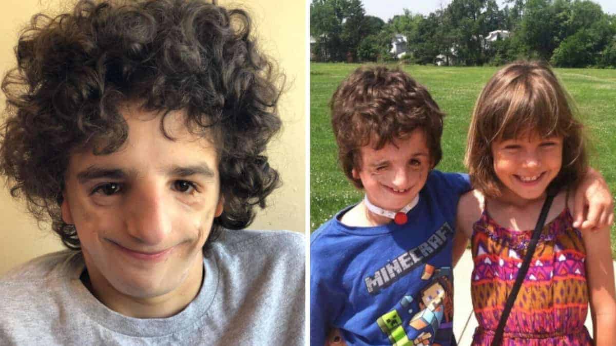 Nathaniel, il ragazzo che è cresciuto essendo chiamato “mostro”, che poi è diventato un’ispirazione per tutti