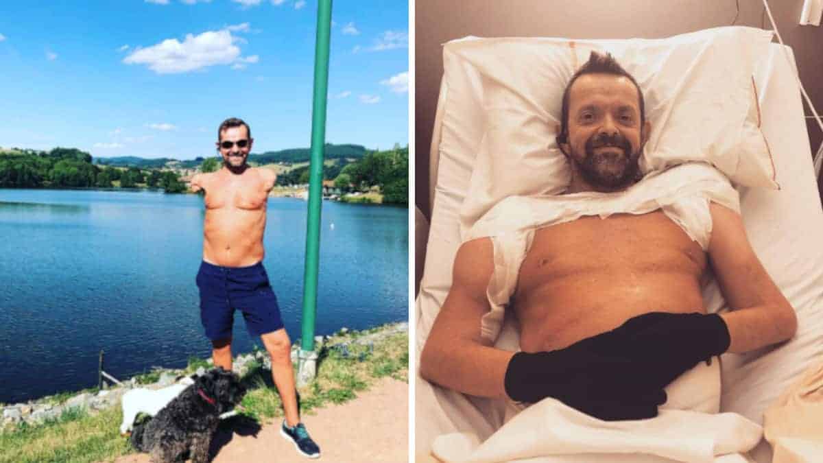Felix è il primo uomo al mondo che ha ricevuto un trapianto di braccia, ecco come sta oggi