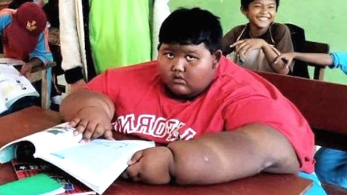 Il ragazzo diventato famoso per pesare quasi 200Kg appare totalmente diverso dopo 2 anni di alimentazione più sana