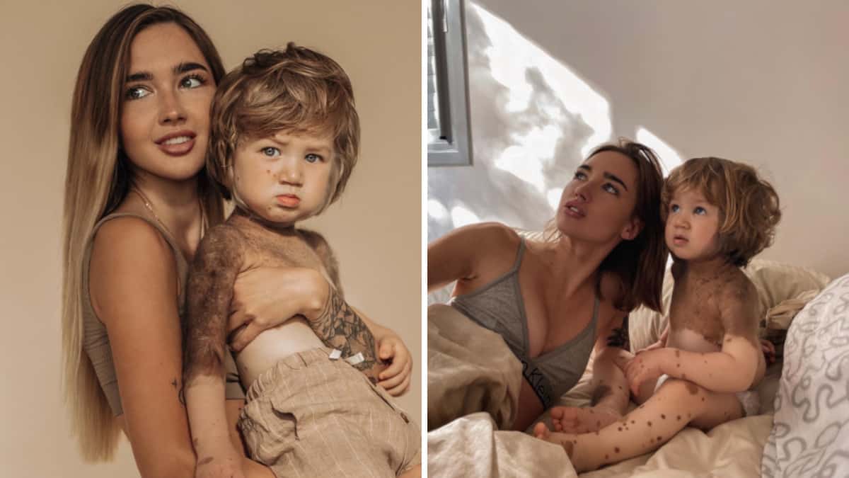 Questo bambino ha un aspetto davvero unico e la sua mamma decide di mostrarlo al mondo intero.