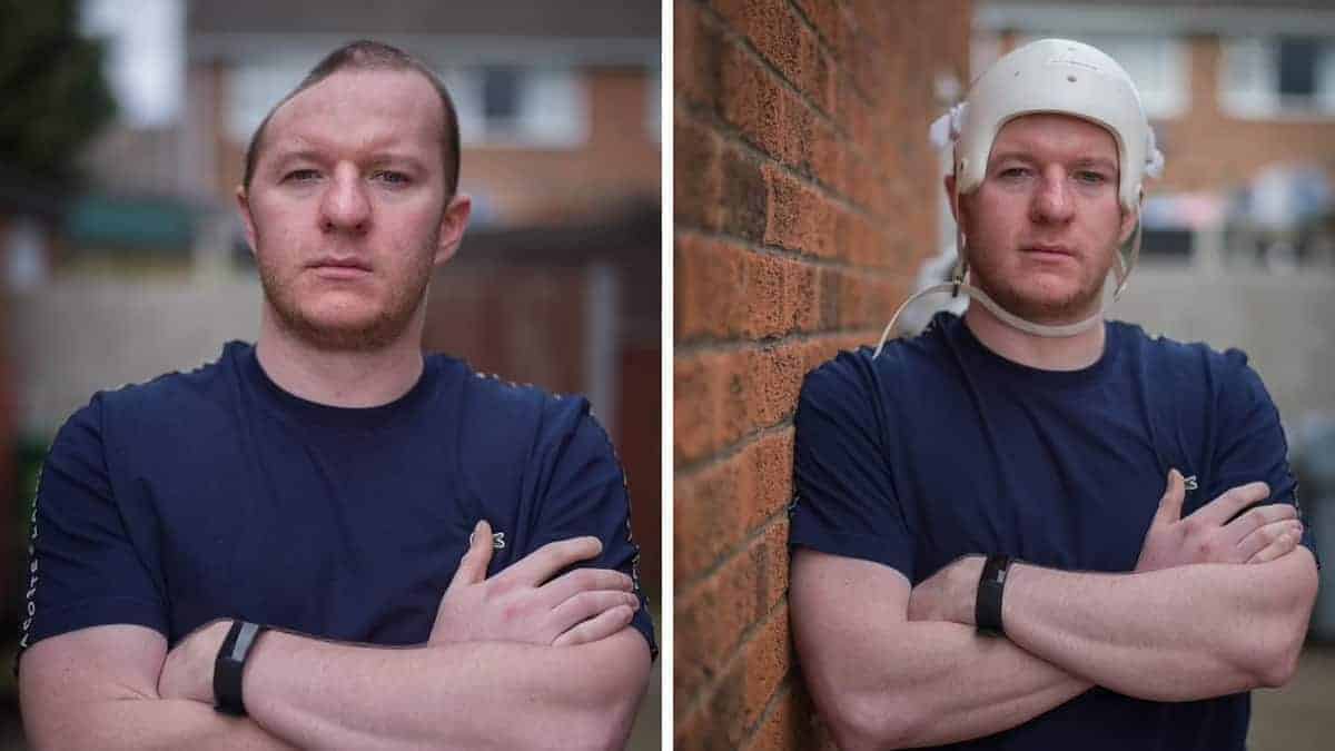 Gli hanno “bucato” il cranio con un colpo e l’aggressore è ancora libero per strada come se niente fosse (FOTO)