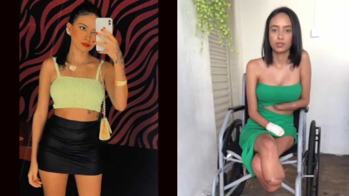 La giovane che ha perso braccia e gambe dopo una grave infezione urinaria lancia il crowdfunding per ottenere delle protesi