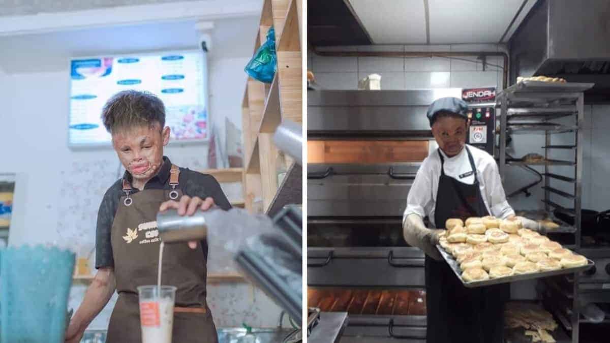 Un sopravvissuto a gravi ustioni, dopo due anni di reclusione in casa, ora ha aperto la sua panetteria: ‘Sono più di quello che sembro’