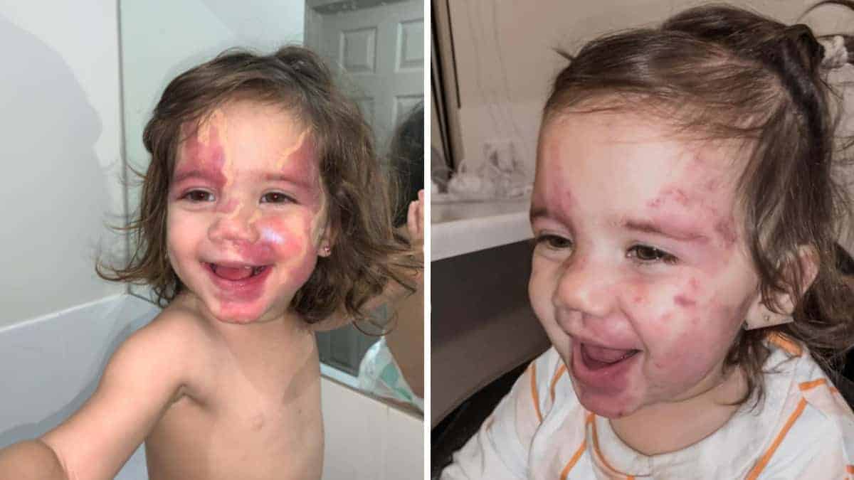 Chiamata ‘difettosa’ per i suoi segni, la madre di questa bambina fa una mossa straordinaria.